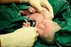 Mit der Geburt beginnt das Baby sofort, selbstständig zu atmen.